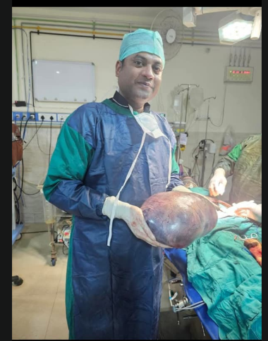 Surgical Removal of Giant Ovarian/Abdominal Cyst